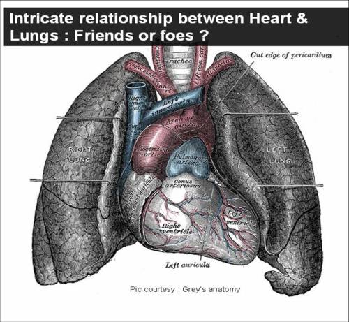 heart lungs pulmonary function test dyspnea cardiomegaly ct ratio