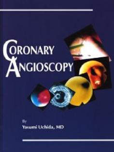 coronary angioscopy Yasumi Uchida
