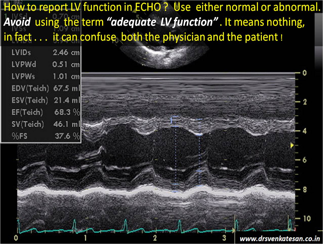 echocardiography | Dr.S.Venkatesan MD | Page 2