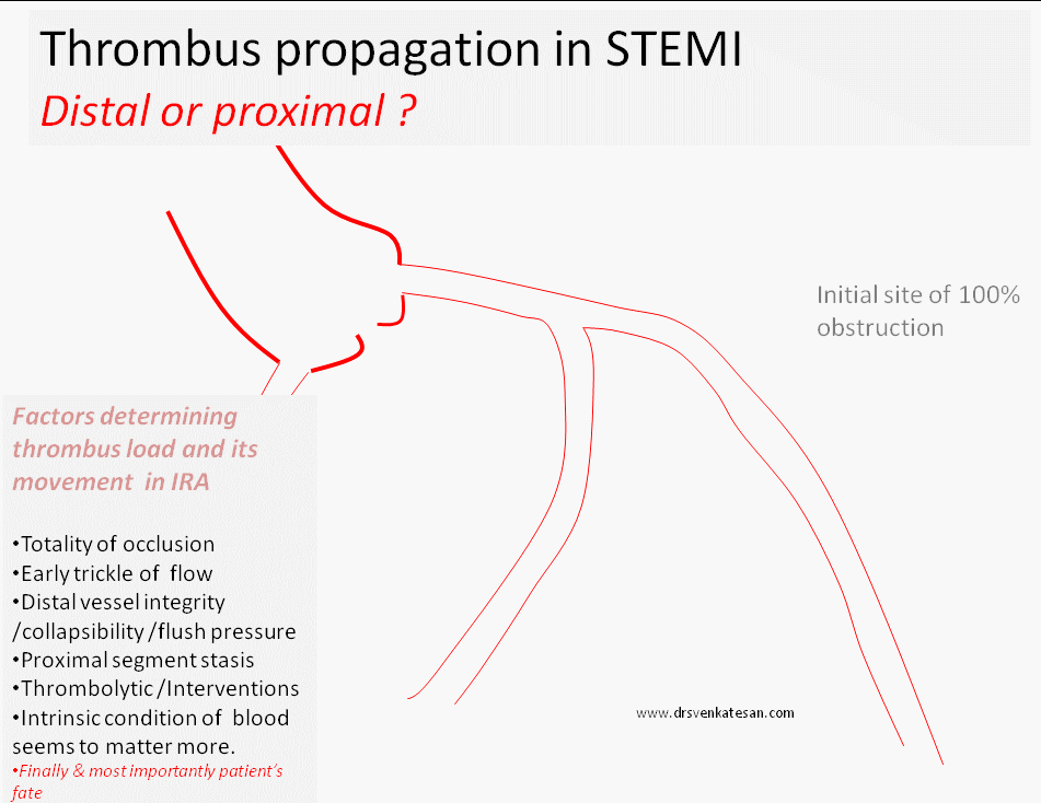thrombus propgation
